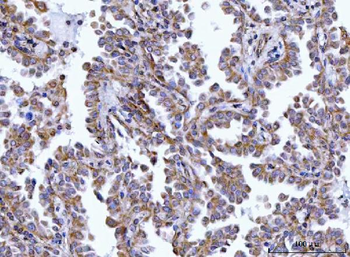 Anti-HAX1 Antibody