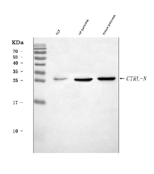 Anti-CTRL Antibody