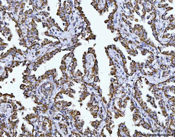 Anti-COX5B Antibody