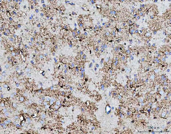 Anti-COX5B Antibody