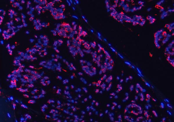 Anti-COX5B Antibody