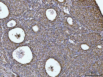 Anti-COX5B Antibody