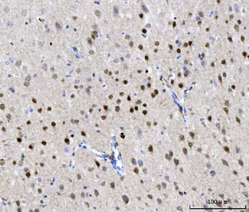Anti-CHD1 Antibody