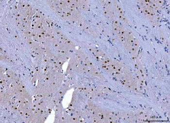 Anti-CHD1 Antibody