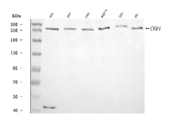 Anti-CHD1 Antibody