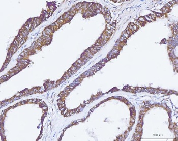 Anti-Carbonic Anhydrase 9/CA9 Antibody