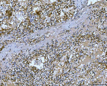 Anti-Carbonic Anhydrase 9/CA9 Antibody