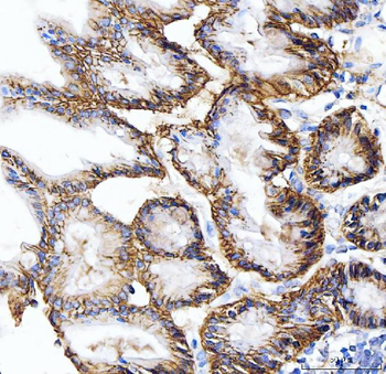 Anti-Carbonic Anhydrase 9/CA9 Antibody