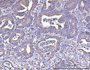 Anti-ATP5F1B Antibody