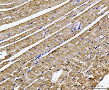 Anti-ATP5F1B Antibody