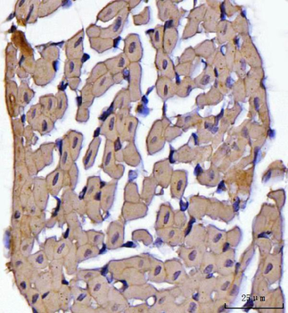 Anti-ATP5F1B Antibody