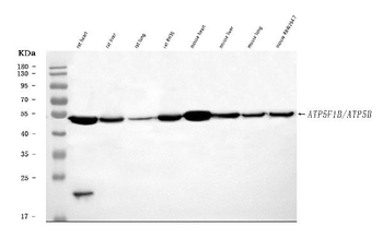 Anti-ATP5F1B Antibody