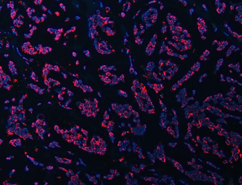 Anti-ATP5F1B Antibody