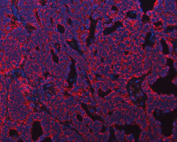 Anti-ATP5F1B Antibody