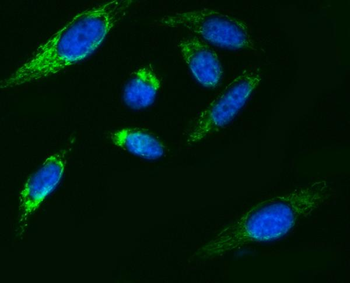 Anti-ATP5F1B Antibody