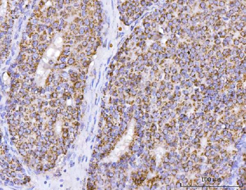 Anti-ATP5F1B Antibody