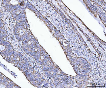 Anti-ATP5F1B Antibody