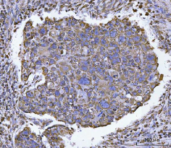 Anti-ATP5F1B Antibody