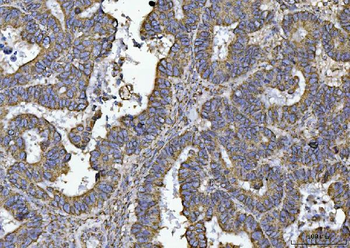 Anti-ATP5F1B Antibody