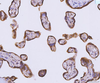 Anti-ATP5F1B Antibody