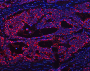 Anti-ATP5F1A Antibody