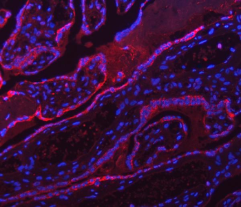 Anti-ATP5F1A Antibody