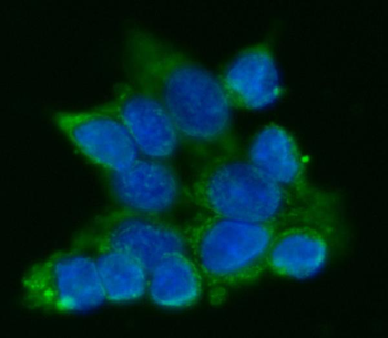 Anti-ATP5F1A Antibody