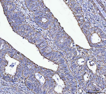 Anti-ATP5F1A Antibody