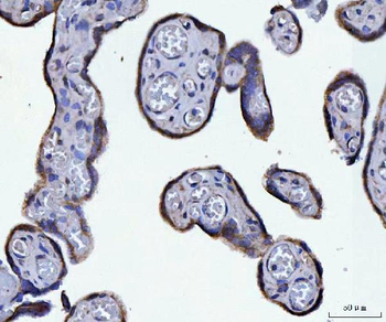 Anti-ATP5F1A Antibody