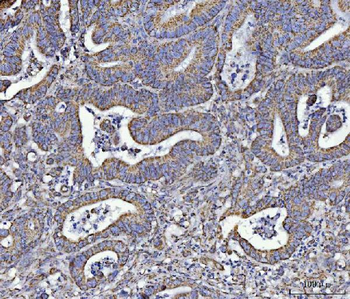 Anti-ATP5F1A Antibody