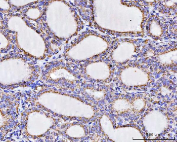 Anti-ATP5F1A Antibody