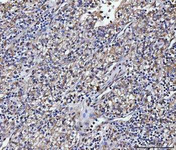 Anti-ATP1B2 Antibody