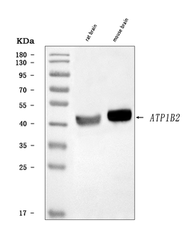 Anti-ATP1B2 Antibody