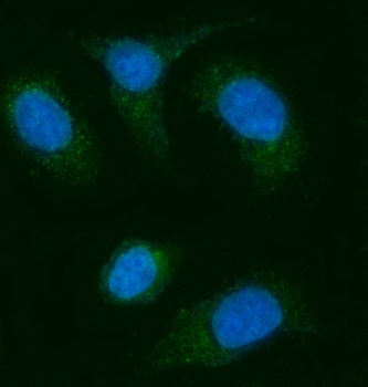 Anti-AGPS Antibody