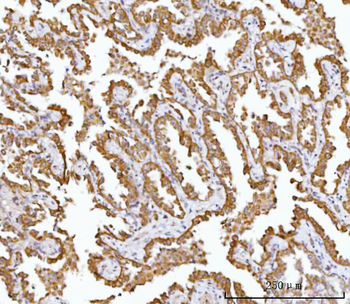 Anti-AGPS Antibody