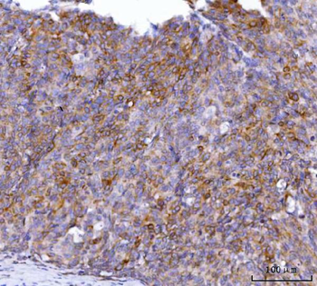 Anti-AGPS Antibody
