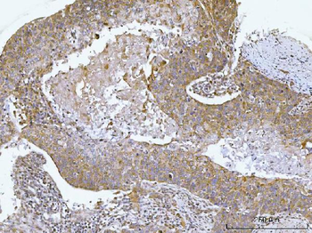 Anti-AGPS Antibody