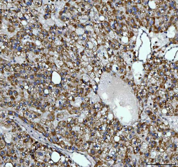 Anti-AGPS Antibody