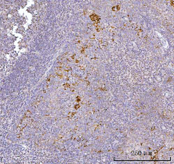 Anti-AGPS Antibody