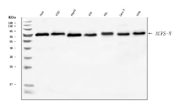 Anti-AGPS Antibody