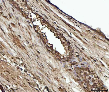 Anti-YWHAE Antibody