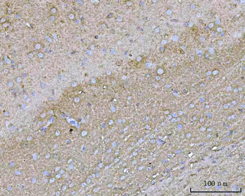 Anti-YWHAE Antibody