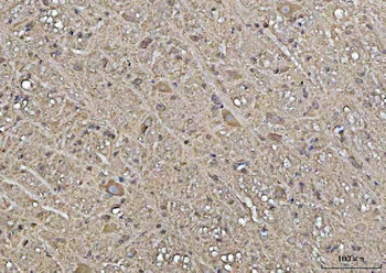 Anti-YWHAE Antibody