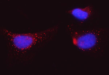 Anti-BI-1/TMBIM6 Antibody