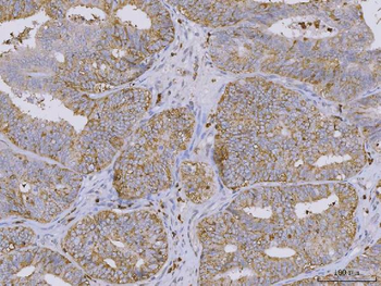 Anti-BI-1/TMBIM6 Antibody