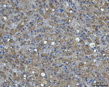 Anti-BI-1/TMBIM6 Antibody