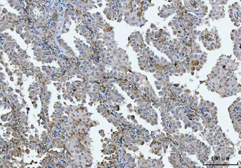 Anti-BI-1/TMBIM6 Antibody