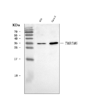 Anti-BI-1/TMBIM6 Antibody