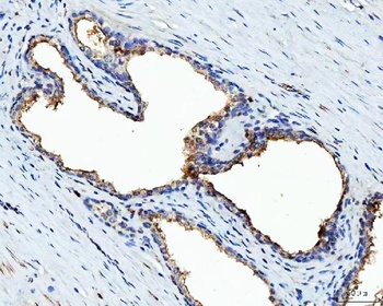 BI-1/TMBIM6 Antibody