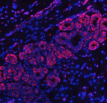 Anti-RPL32 Antibody